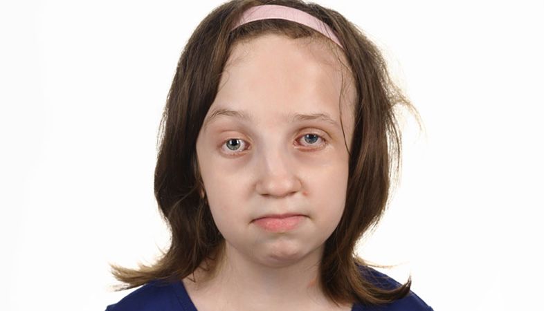 Julia kontra okrutne diagnozy. Uratuj ją przed kolejnym bólem!