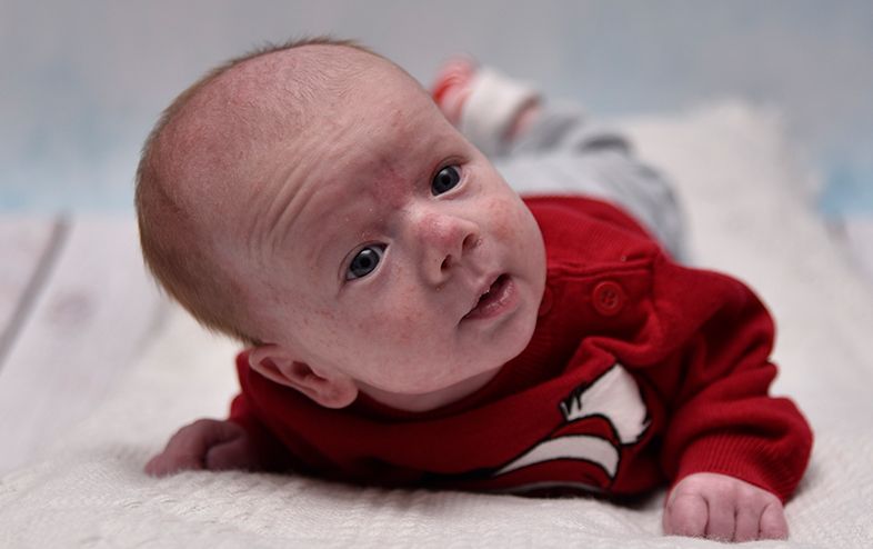 Ignaś potrzebuje kolejnej operacji ratującej jego życie