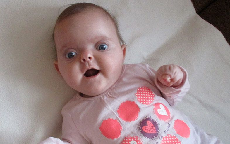 Karolinka musi pilnie przejść operację czaszki