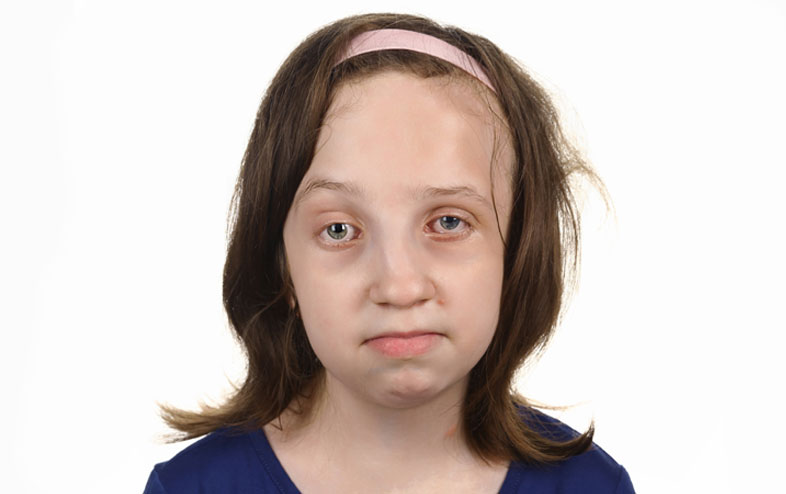Julia kontra okrutne diagnozy. Uratuj ją przed kolejnym bólem!