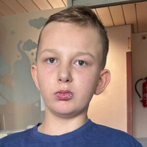 Życie Oliwiera to cud. Sprawmy aby mógł chodzić!